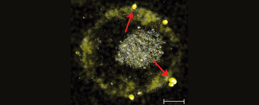 A Bacterial Alternative to How is Gold Made in Nature